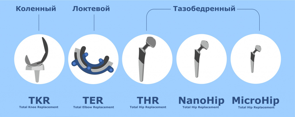 Протезирование.jpg